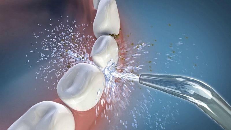 Máy tăm nước giúp làm sạch hoàn toàn mảng bám ở vững vùng khuất trên răng