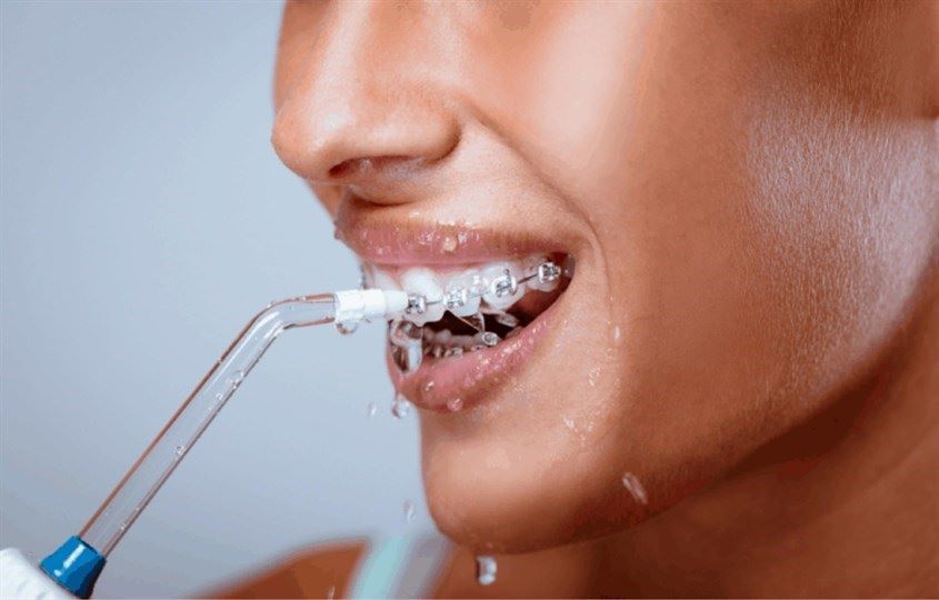 Bạn nên mức điều chỉnh áp lực nước phù hợp để không gây tổn thương cho nướu